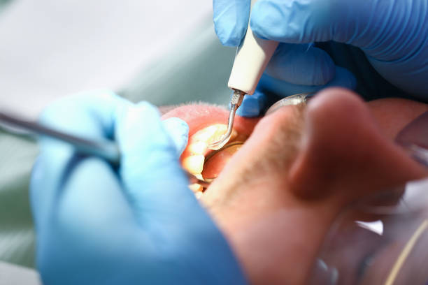 Best Emergency Gum Treatment in Midlothian, VA