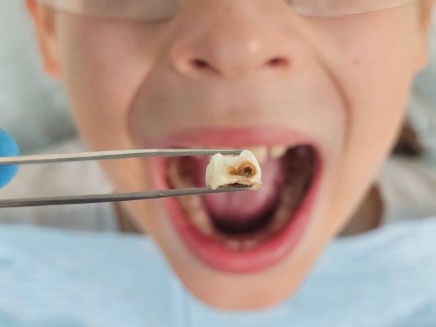 Best Same-Day Emergency Dental Services in Midlothian, VA
